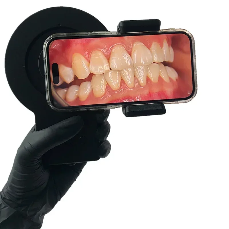 Equipo de fotografía dental Fu - Photography Lighting Diy reseña y precio